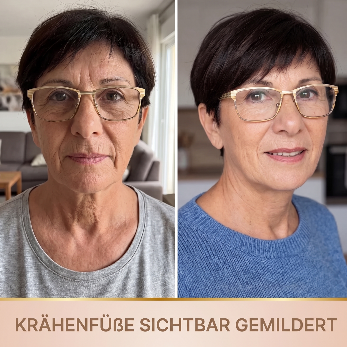 BioVeliere® - Lifting-Serum
