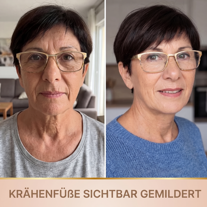 BioVeliere® - Lifting-Serum